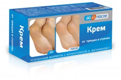 Крем для ног от трещин в ступнях 150 мл